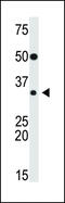 SNAI2 antibody, MBS9200693, MyBioSource, Western Blot image 