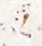  antibody, GTX53625, GeneTex, Immunohistochemistry paraffin image 