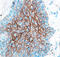 Cathepsin V antibody, AF1080, R&D Systems, Immunohistochemistry paraffin image 