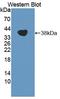 Transient Receptor Potential Cation Channel Subfamily A Member 1 antibody, LS-C373406, Lifespan Biosciences, Western Blot image 