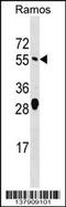 ADP Ribosylation Factor GTPase Activating Protein 2 antibody, 59-268, ProSci, Western Blot image 