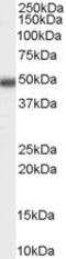 Methyl-CpG Binding Domain Protein 2 antibody, PA5-18619, Invitrogen Antibodies, Western Blot image 