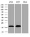 Anterior Gradient 2, Protein Disulphide Isomerase Family Member antibody, LS-C792213, Lifespan Biosciences, Western Blot image 