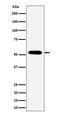Protein Phosphatase 2 Regulatory Subunit B'Epsilon antibody, M07588-1, Boster Biological Technology, Western Blot image 