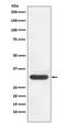 Cyclin Dependent Kinase 4 antibody, M00159, Boster Biological Technology, Western Blot image 