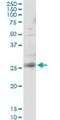 RAB3B, Member RAS Oncogene Family antibody, H00005865-M02, Novus Biologicals, Immunoprecipitation image 