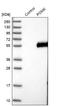 Protein O-Mannose Kinase antibody, NBP2-13302, Novus Biologicals, Western Blot image 