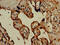 Hydroxy-Delta-5-Steroid Dehydrogenase, 3 Beta- And Steroid Delta-Isomerase 1 antibody, CSB-PA010781LA01HU, Cusabio, Immunohistochemistry paraffin image 