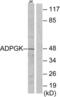 ADP Dependent Glucokinase antibody, LS-C119232, Lifespan Biosciences, Western Blot image 