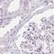 Serpin Family B Member 1 antibody, NBP2-49056, Novus Biologicals, Immunohistochemistry paraffin image 