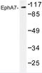 EPH Receptor A7 antibody, AP06735PU-N, Origene, Western Blot image 
