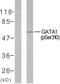 GATA Binding Protein 1 antibody, LS-C117364, Lifespan Biosciences, Western Blot image 