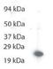 TIMP Metallopeptidase Inhibitor 4 antibody, NBP1-28619, Novus Biologicals, Western Blot image 