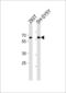 Iroquois-class homeodomain protein IRX-3 antibody, LS-C165297, Lifespan Biosciences, Western Blot image 