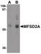 Major Facilitator Superfamily Domain Containing 2A antibody, PA5-21049, Invitrogen Antibodies, Western Blot image 