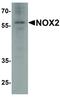 Cytochrome B-245 Beta Chain antibody, LS-C336199, Lifespan Biosciences, Western Blot image 