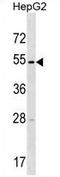 Transmembrane Serine Protease 11E antibody, AP54297PU-N, Origene, Western Blot image 