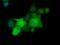 Phosphoribosylaminoimidazole Carboxylase And Phosphoribosylaminoimidazolesuccinocarboxamide Synthase antibody, GTX83950, GeneTex, Immunocytochemistry image 