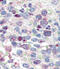 Snail Family Transcriptional Repressor 1 antibody, abx031509, Abbexa, Western Blot image 