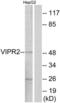 Vasoactive Intestinal Peptide Receptor 2 antibody, LS-C199726, Lifespan Biosciences, Western Blot image 