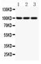 Nuclear Factor Kappa B Subunit 2 antibody, PB9150, Boster Biological Technology, Western Blot image 