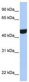 Zinc Finger Protein 550 antibody, TA341506, Origene, Western Blot image 