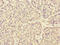 Rho Guanine Nucleotide Exchange Factor 3 antibody, LS-C675388, Lifespan Biosciences, Immunohistochemistry paraffin image 