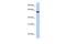 Adhesion Molecule With Ig Like Domain 3 antibody, A13666, Boster Biological Technology, Western Blot image 