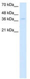 CTD Small Phosphatase Like antibody, TA346421, Origene, Western Blot image 