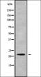 Mediator Complex Subunit 11 antibody, orb338408, Biorbyt, Western Blot image 