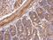 5-Hydroxytryptamine Receptor 1A antibody, GTX104703, GeneTex, Immunohistochemistry paraffin image 