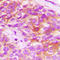 ELOVL Fatty Acid Elongase 5 antibody, abx121959, Abbexa, Western Blot image 