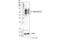 Interleukin 13 Receptor Subunit Alpha 2 antibody, 85677S, Cell Signaling Technology, Western Blot image 