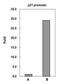 Peptidyl Arginine Deiminase 4 antibody, PA5-22317, Invitrogen Antibodies, Chromatin Immunoprecipitation image 