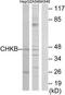 Choline Kinase Beta antibody, TA313620, Origene, Western Blot image 