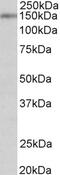 Cytochrome P450 Family 1 Subfamily A Member 2 antibody, 42-901, ProSci, Enzyme Linked Immunosorbent Assay image 