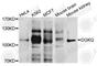 DGK0 antibody, A3825, ABclonal Technology, Western Blot image 