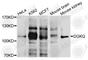 Diacylglycerol Kinase Theta antibody, A3825, ABclonal Technology, Western Blot image 