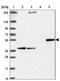Cytochrome P450 Family 27 Subfamily A Member 1 antibody, NBP2-32433, Novus Biologicals, Western Blot image 