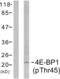 Eukaryotic Translation Initiation Factor 4E Binding Protein 1 antibody, LS-C117284, Lifespan Biosciences, Western Blot image 