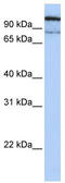 Lysosomal alpha-glucosidase antibody, TA334653, Origene, Western Blot image 