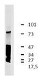 Leucine-rich repeat-containing protein 32 antibody, M08199, Boster Biological Technology, Western Blot image 
