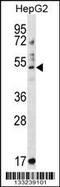 Tripartite Motif Containing 11 antibody, 56-968, ProSci, Western Blot image 