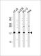 Stathmin 1 antibody, M01194-2, Boster Biological Technology, Western Blot image 