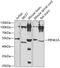 Phosphatidylinositol-5-Phosphate 4-Kinase Type 2 Alpha antibody, 22-946, ProSci, Western Blot image 