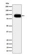 Activated Leukocyte Cell Adhesion Molecule antibody, M01788, Boster Biological Technology, Western Blot image 