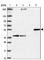 Cytochrome P450 Family 27 Subfamily A Member 1 antibody, HPA059155, Atlas Antibodies, Western Blot image 