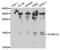 S100 Calcium Binding Protein A12 antibody, MBS129694, MyBioSource, Western Blot image 