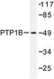 Protein Tyrosine Phosphatase Non-Receptor Type 1 antibody, LS-C176463, Lifespan Biosciences, Western Blot image 