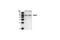 TNF Receptor Associated Factor 2 antibody, 4712S, Cell Signaling Technology, Western Blot image 